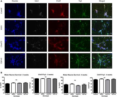 Modeling Protein Aggregation and the Heat Shock Response in ALS iPSC-Derived Motor Neurons